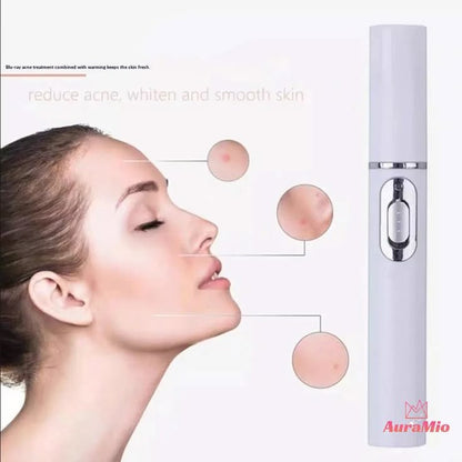 Portable Blue Light Acne Treatment Pen | USB Rechargeable LED Pimple & Blemish Remover for Clear, Healthy-Looking Skin